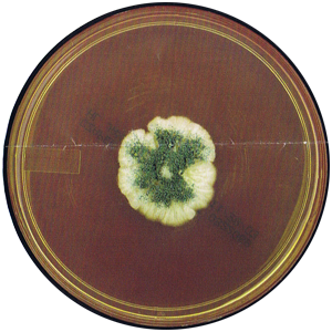 Aspergillus