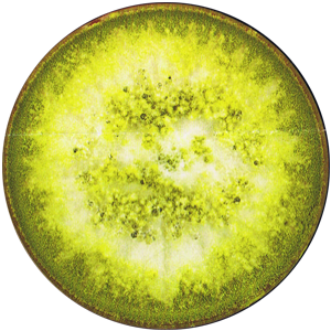 Aspergillus