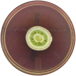 Aspergillus